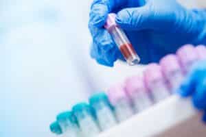 Bluttest Apotheke